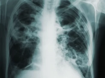 Claire Black Therapy Blog Image